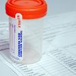 drug-test-image on employee screening blog